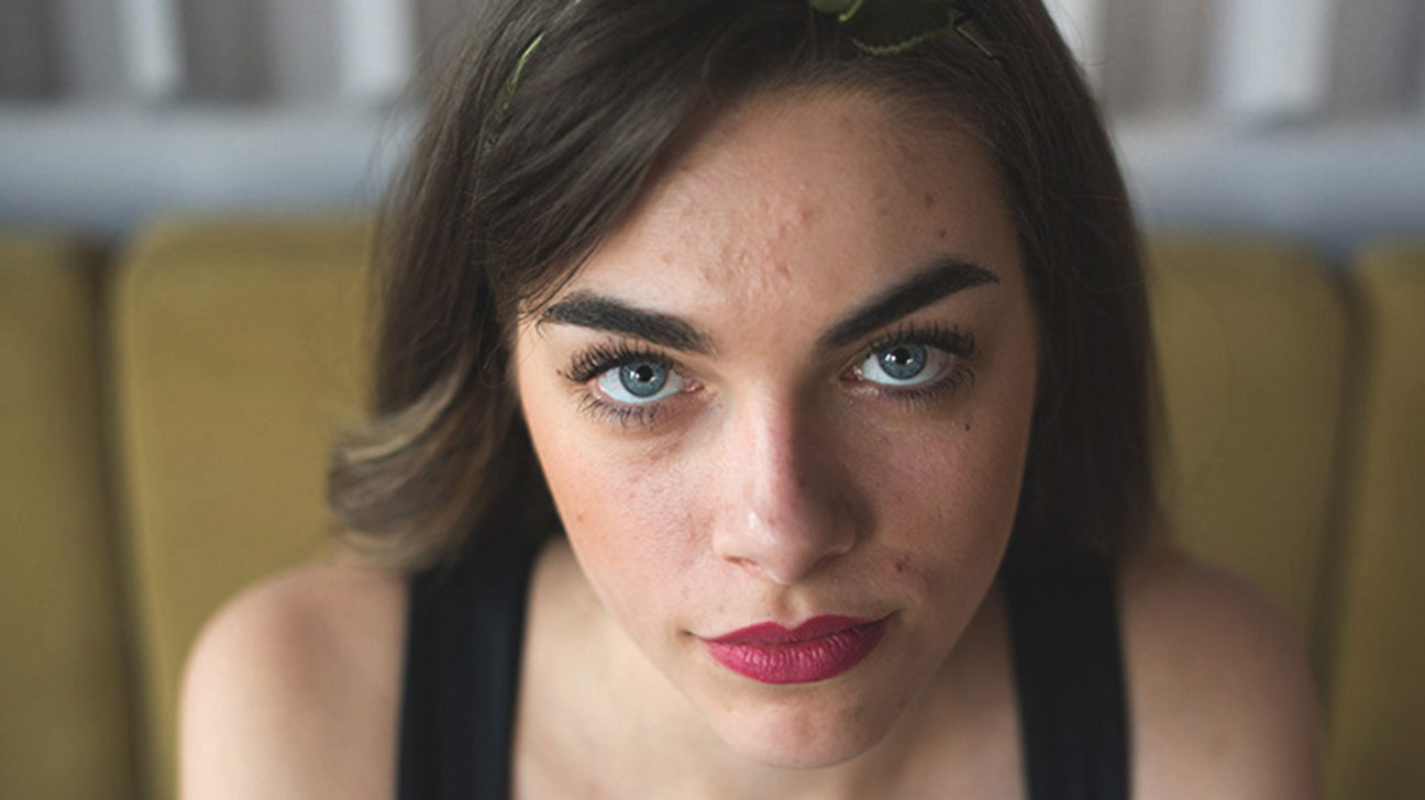 Does Oily Face Cause Pimples? The Truth You Need to Know